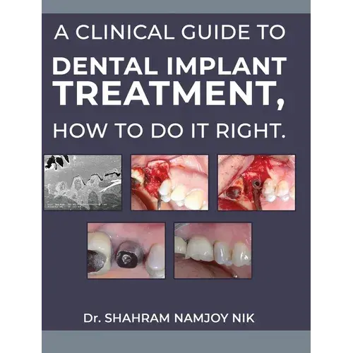 A Clinical Guide To Dental Implant Treatment, How To Do It Right. - Hardcover 1