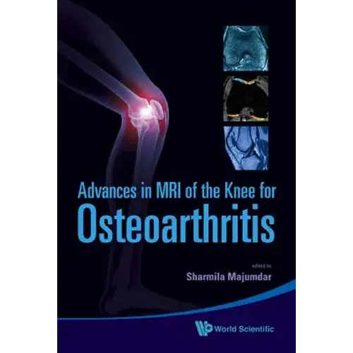 Adv In Mri Of The Knee For Osteoarthriti - Hardcover 1