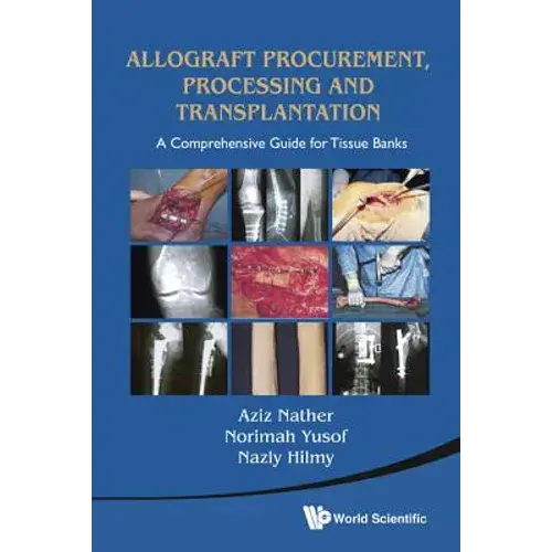 Allograft Procurement, Processing And .. - Hardcover 1