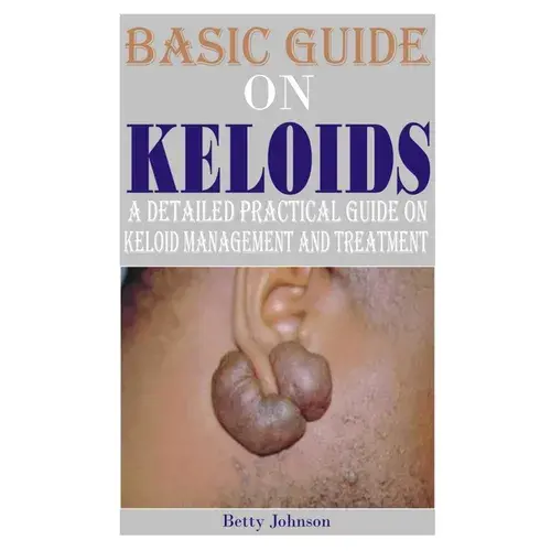 Basic Guide On Keloids: A Detailed Practical Guide On Keloid Management And Treatment - Paperback 1