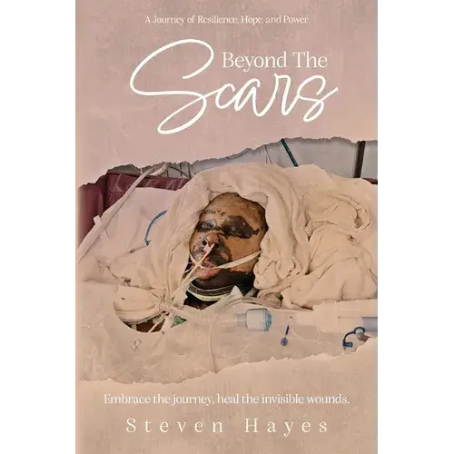 Beyond The Scars: A Journey Of Resilience, Hope, And Power - Paperback 1