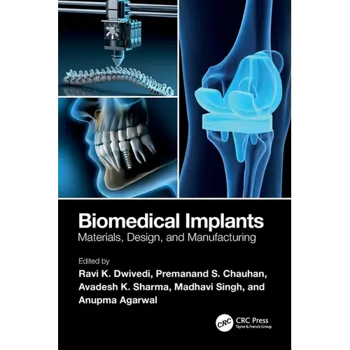 Biomedical Implants: Materials, Design, And Manufacturing - Paperback 1