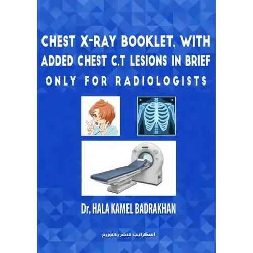 Chest X-Ray Booklet, With Added Chest C.T Lesions In Brief Only For Radiologists - Paperback 1