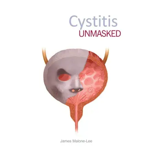 Cystitis Unmasked - Paperback 1