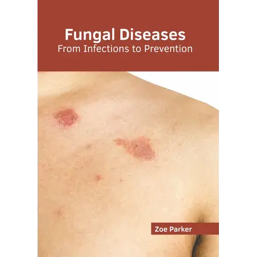Fungal Diseases: From Infections To Prevention - Hardcover 1