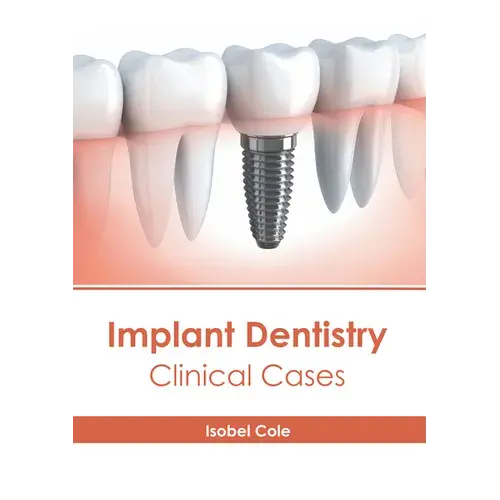 Implant Dentistry: Clinical Cases - Hardcover 1