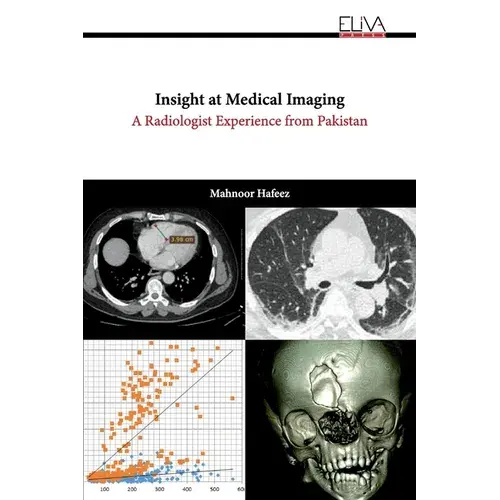 Insight At Medical Imaging: A Radiologist Experience From Pakistan - Paperback 1