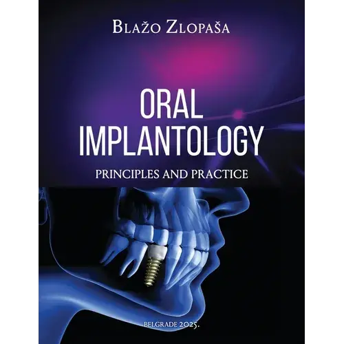 Oral Implantology: Principles And Practice - Paperback 1