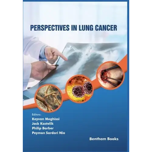 Perspectives In Lung Cancer - Paperback 1