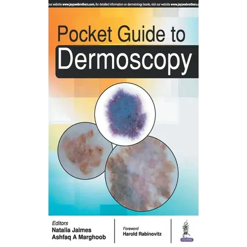 Pocket Guide To Dermoscopy - Paperback 1