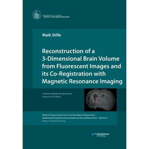Reconstruction Of A 3-Dimensional Brain Volume From Fluorescent Images And Its Co-Registration With Magnetic Resonance Imaging - Paperback 1