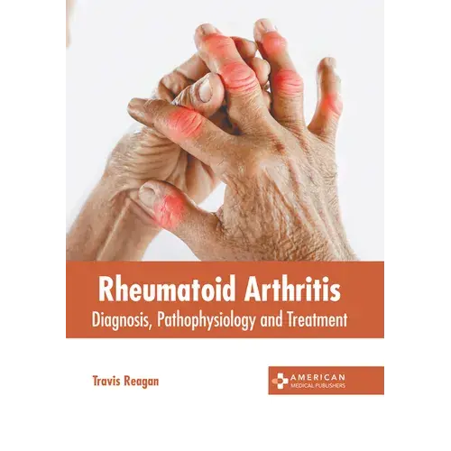 Rheumatoid Arthritis: Diagnosis, Pathophysiology And Treatment - Hardcover 1