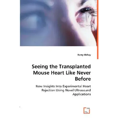 Seeing The Transplanted Mouse Heart Like Never Before - Paperback 1
