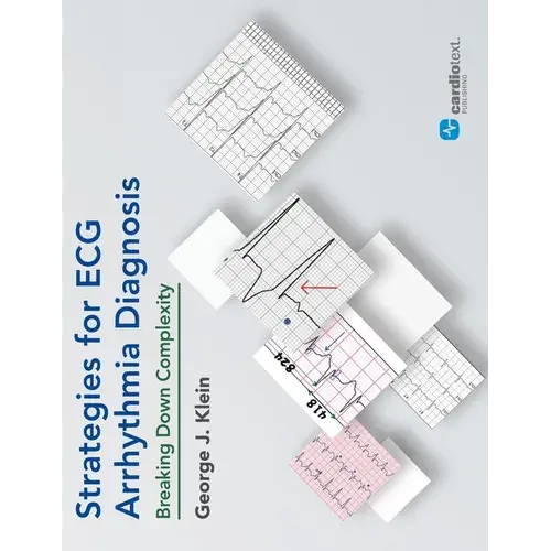 Strategies For Ecg Arrhythmia Diagnosis: Breaking Down Comlexity: Breaking Down Complexity - Paperback 1