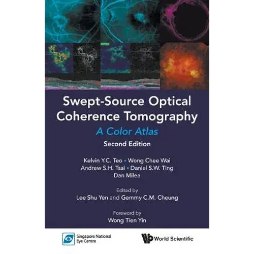 Swept-Source Optic Cohe (2Nd Ed) - Paperback 1