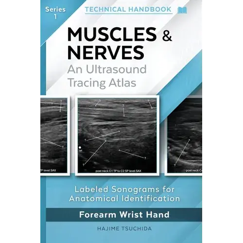Technical Ultrasound Handbook - Muscles & Nerves: An Ultrasound Tracing Atlas (Series 1) - Paperback 1