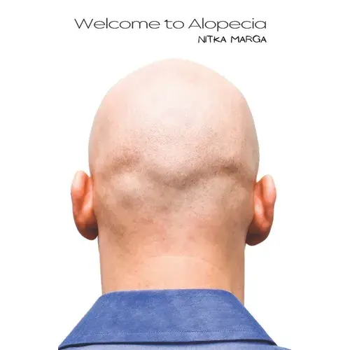 Welcome To Alopecia - Paperback 1